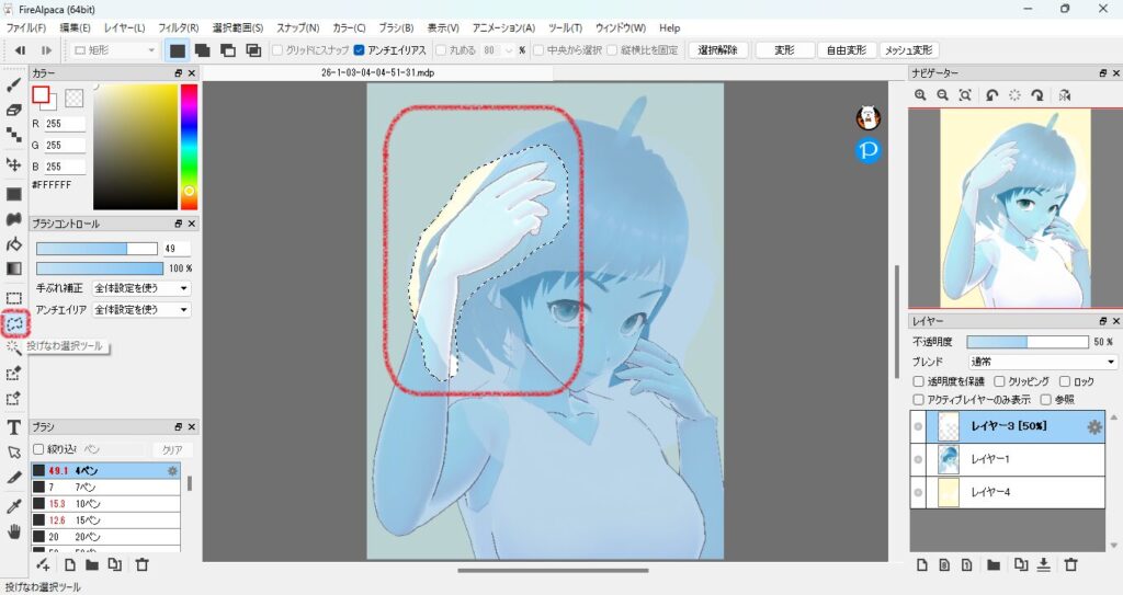 616practice-illustration16-10select